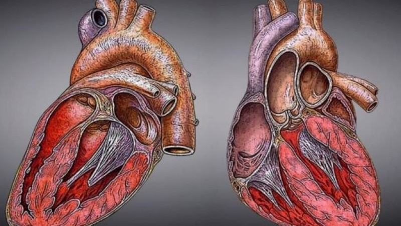 Cardiomegalia, puede ser patológico