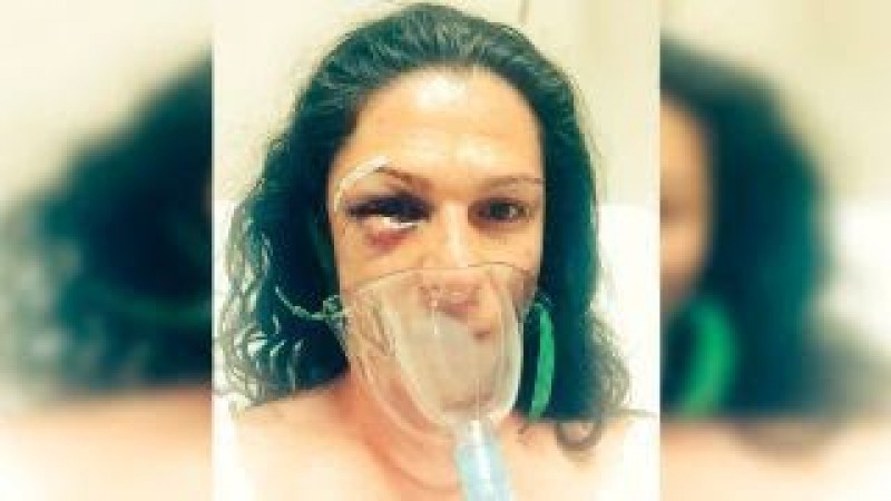 Cuatro hombres golpean a Ana Gabriela Guevara