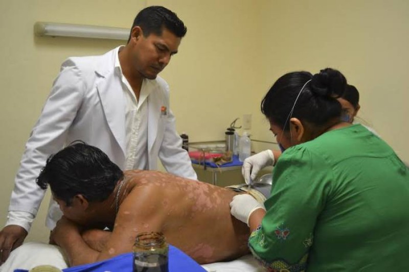 Sinaloa el estado con más casos de lepra en México