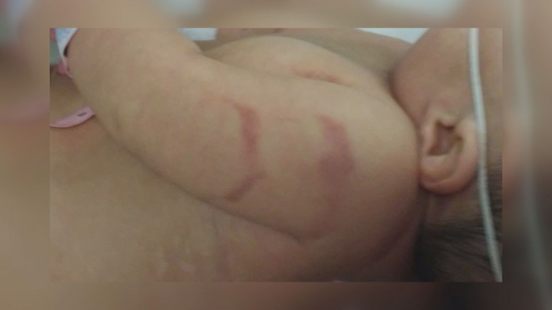 Denuncian falta de atención por enfermera del Hospital de la Mujer