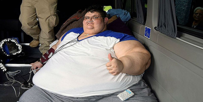 Mexicano podría ser el hombre más obeso del mundo