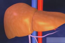 Hepatitis Medicamentosa también es conocida como Hepatitis Tóxica