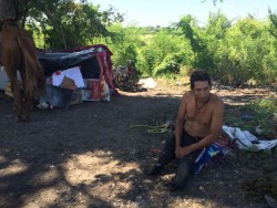 Juan necesita prótesis para sus piernas