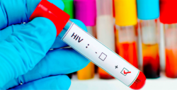 Logran identificar un anticuerpo que neutraliza al 98% el VIH