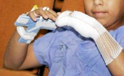 Registra el HIES al primer menor lesionado por pirotecnia de la temporada