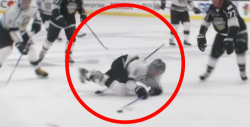 VIDEO: Justin Bieber recibe tremendo golpe jugando hockey