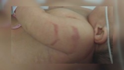 Denuncian falta de atención por enfermera del Hospital de la Mujer