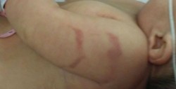 Aseguran que no recibió maltrato menor en el Hospital de la Mujer