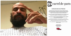 El 'Babo' de Cártel de Santa se rompió una pierna
