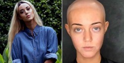 Modelo con alopecia manda un mensaje de reflexión