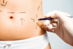 Llama Secretaria de Salud a buscar cirujanos plásticos certificados