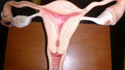 Cáncer de ovarios de los más agresivos en la mujer