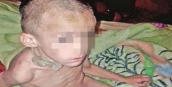 Antony se recupera, ya lejos del infierno que vivió
